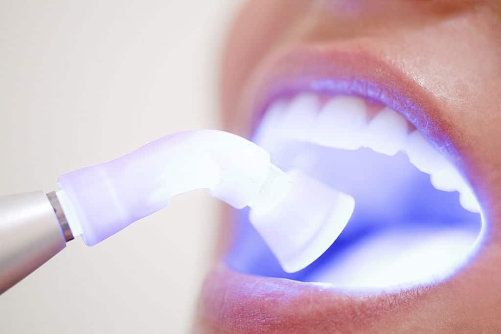 Argumente pentru care laserul dentar este o abordare recomandata in numeroase tratamente stomatologice
