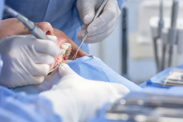 tratament-gingival-avansat-cand-detartrajul-nu-mai-e-suficient-si-ce-presupune